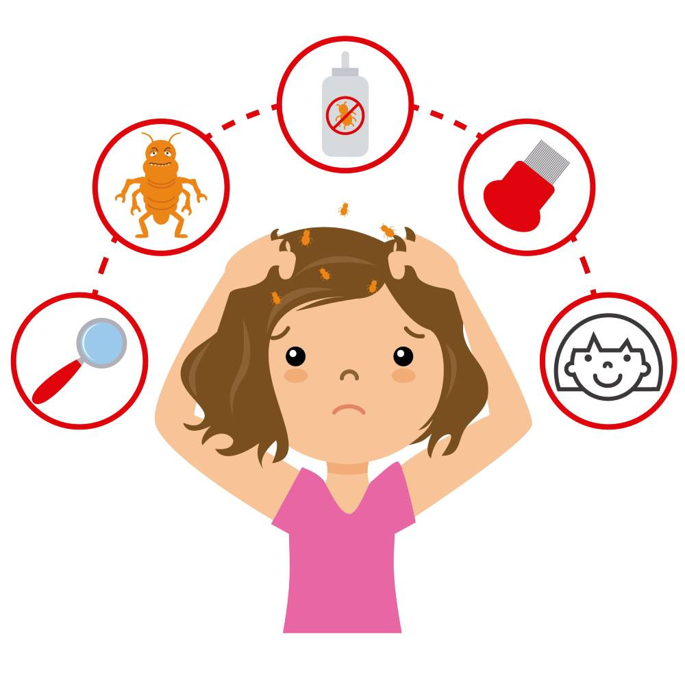 Kecil-Kecil Bikin Bete, Ini Fakta Kutu Rambut yang Sering Ganggu Kenyamananmu